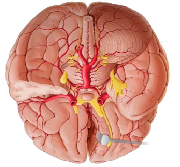 arteries-of-brain