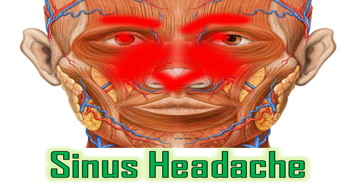 sinus Headache Symptoms Treatments Causes