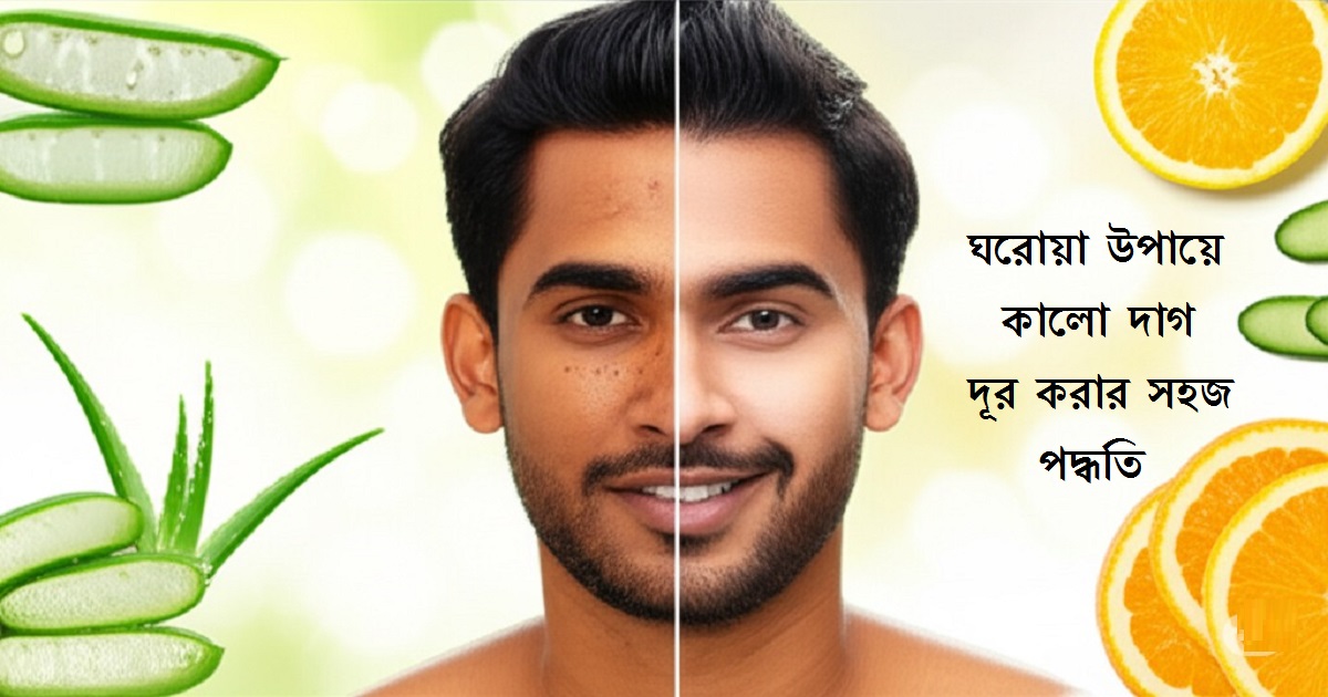পুরুষের মুখের কালো দাগ দূর করার উপায়
